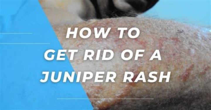 Can you get a rash from juniper bush?