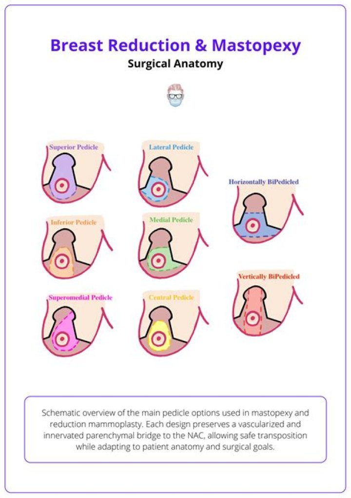 Can you still breastfeed after breast reduction surgery?