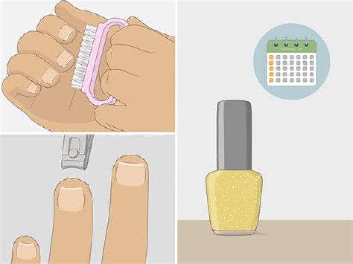 Does cutting nail get rid of fungus?