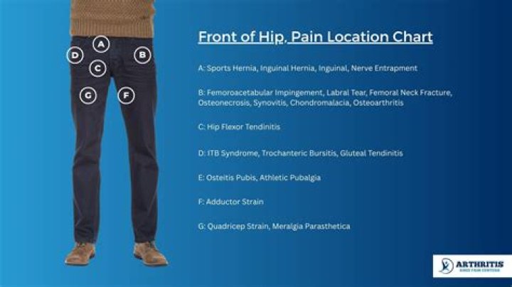 Does hip arthritis hurt when sitting?