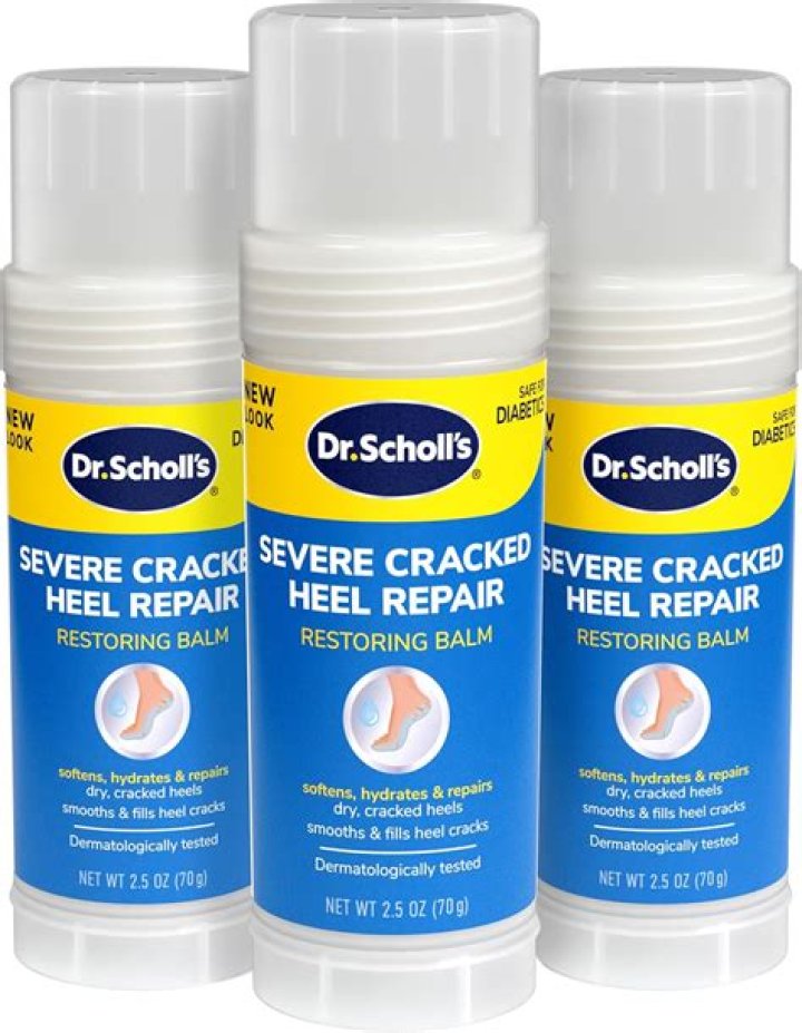 Does Scholl cracked heel cream work?