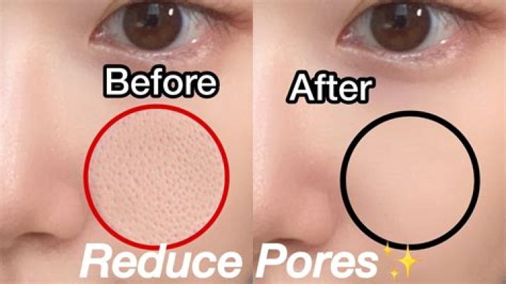 How can I reduce my enlarged pores?