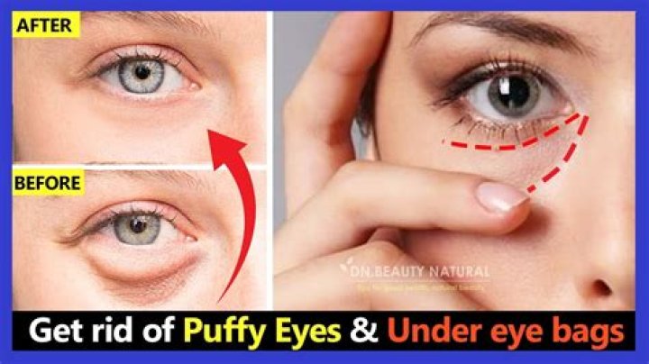 How do I get rid of a bubble under my eye?