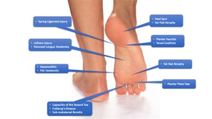 How do I stop my ankles from hurting when I run?