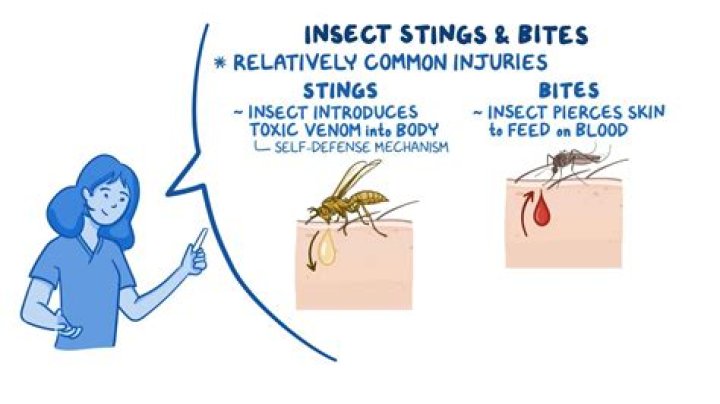 How do you treat Bullae from insect bites?