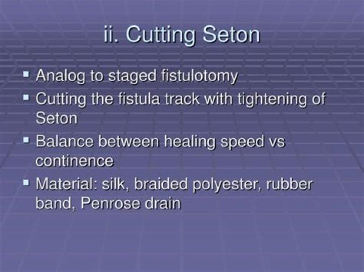 How long does a cutting seton last?
