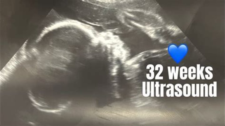 Is a 32 week ultrasound normal?