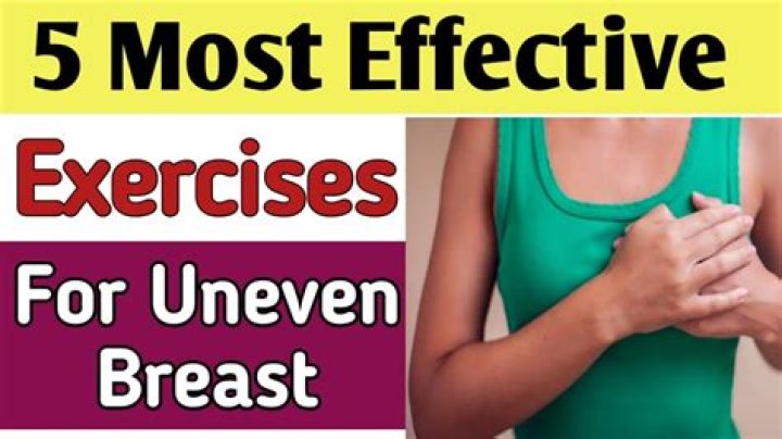 Is it normal for breasts to be uneven after breast reduction?