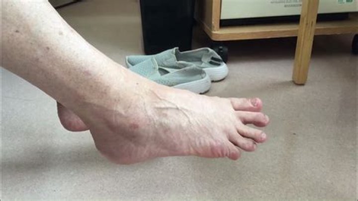 Is it possible to move toes individually?
