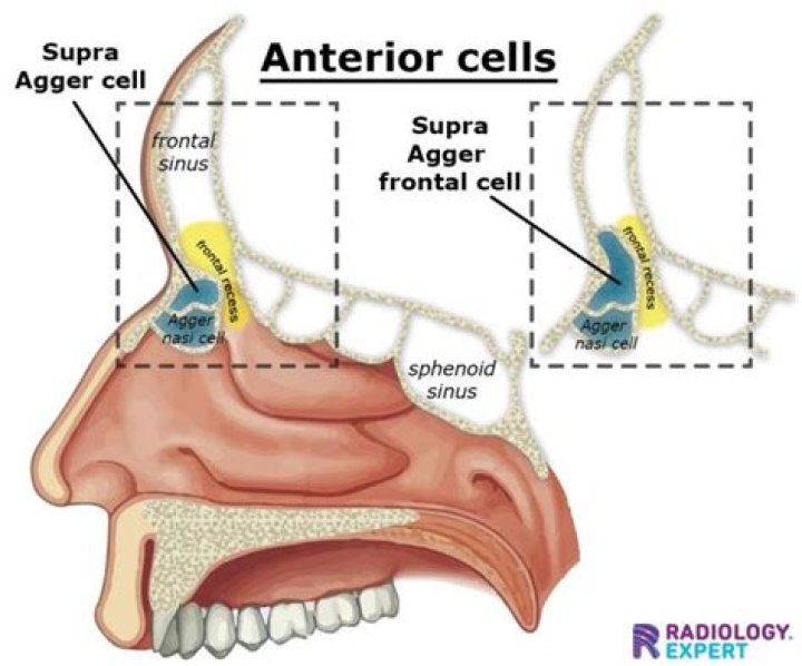 What are agger nasi cells?