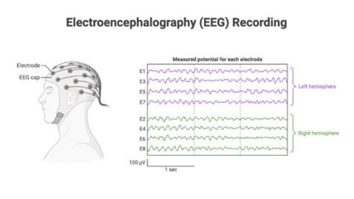 What are the EEG recording modes?