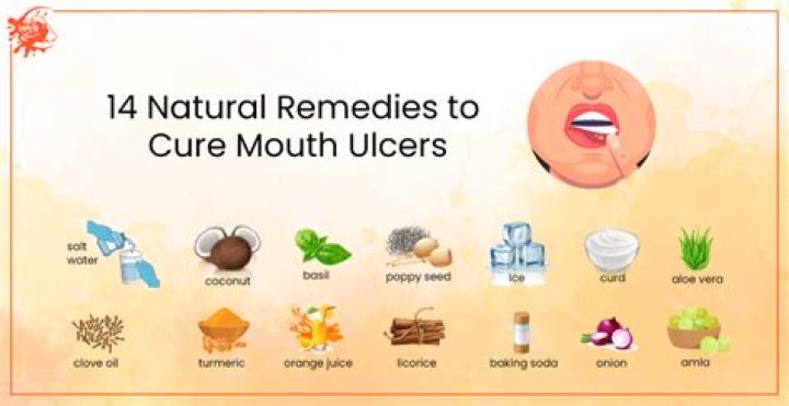What can I use for mouth ulcers when pregnant?