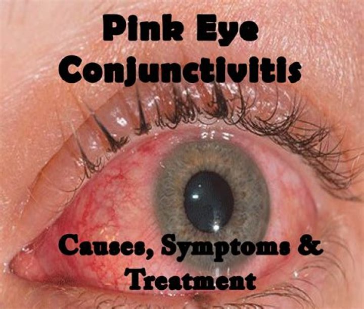 What causes double pink eye?