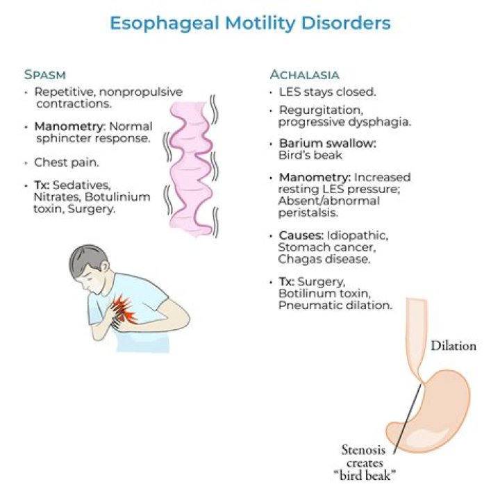 What causes esophageal spasms at night?
