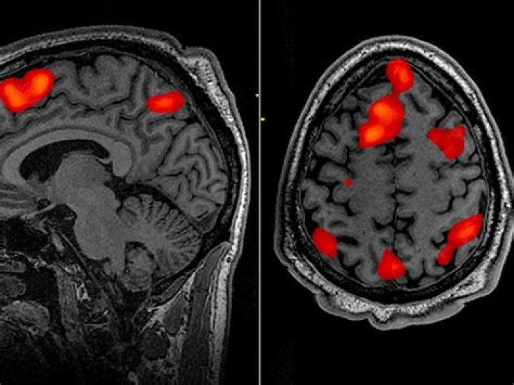 What is a fMRI used for?