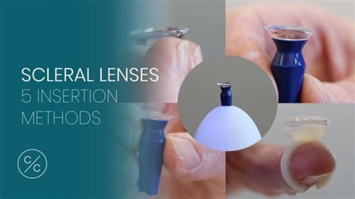 What is a mini scleral lens?