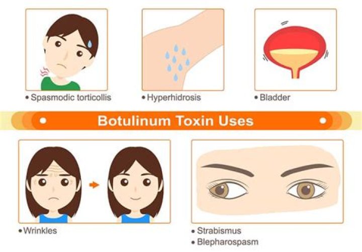 What is botulinum toxin used to treat?