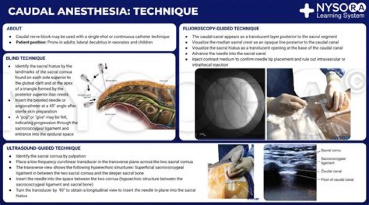 What is caudal anatomy?