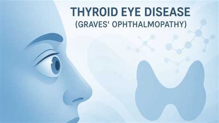 What is Ophthalmopathy?
