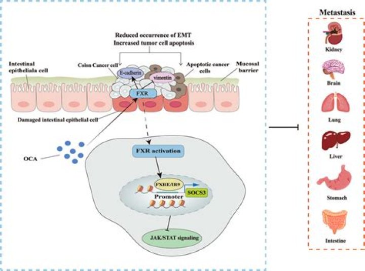 What structures are most likely to be site of Extracolonic disease in inflammatory bowel disease?