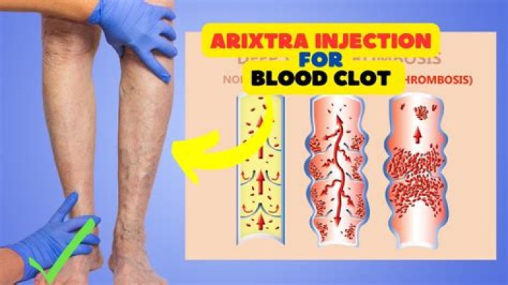Where do you inject Arixtra?