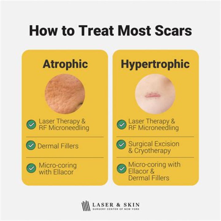 Which is the best way to remove scar marks?