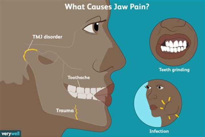 Why does my jaw hurt when I eat something tart?
